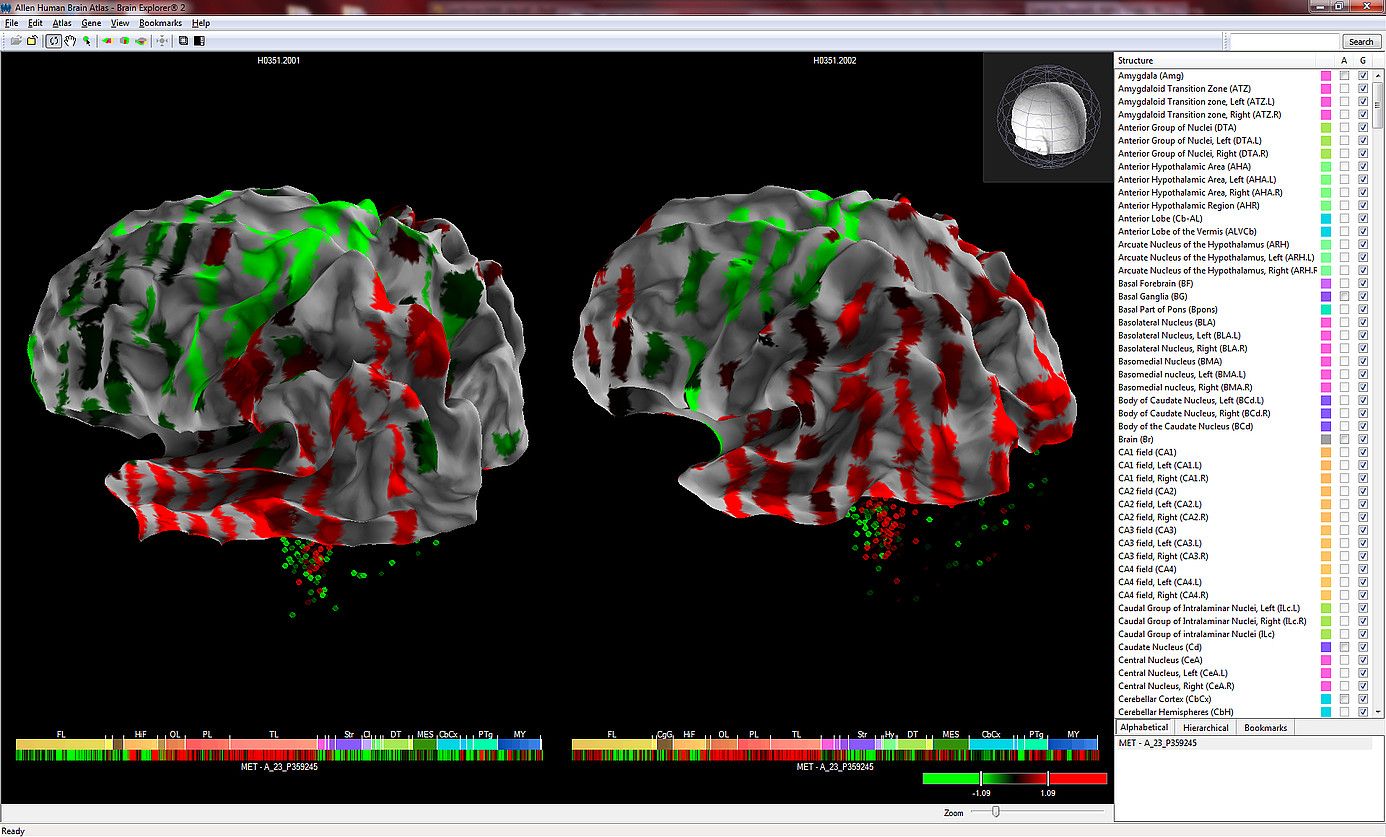 Garunaren barne egituretako gene baten espresioa. ALLEN INSTITUTE FOR BRAIN SCIENCE.