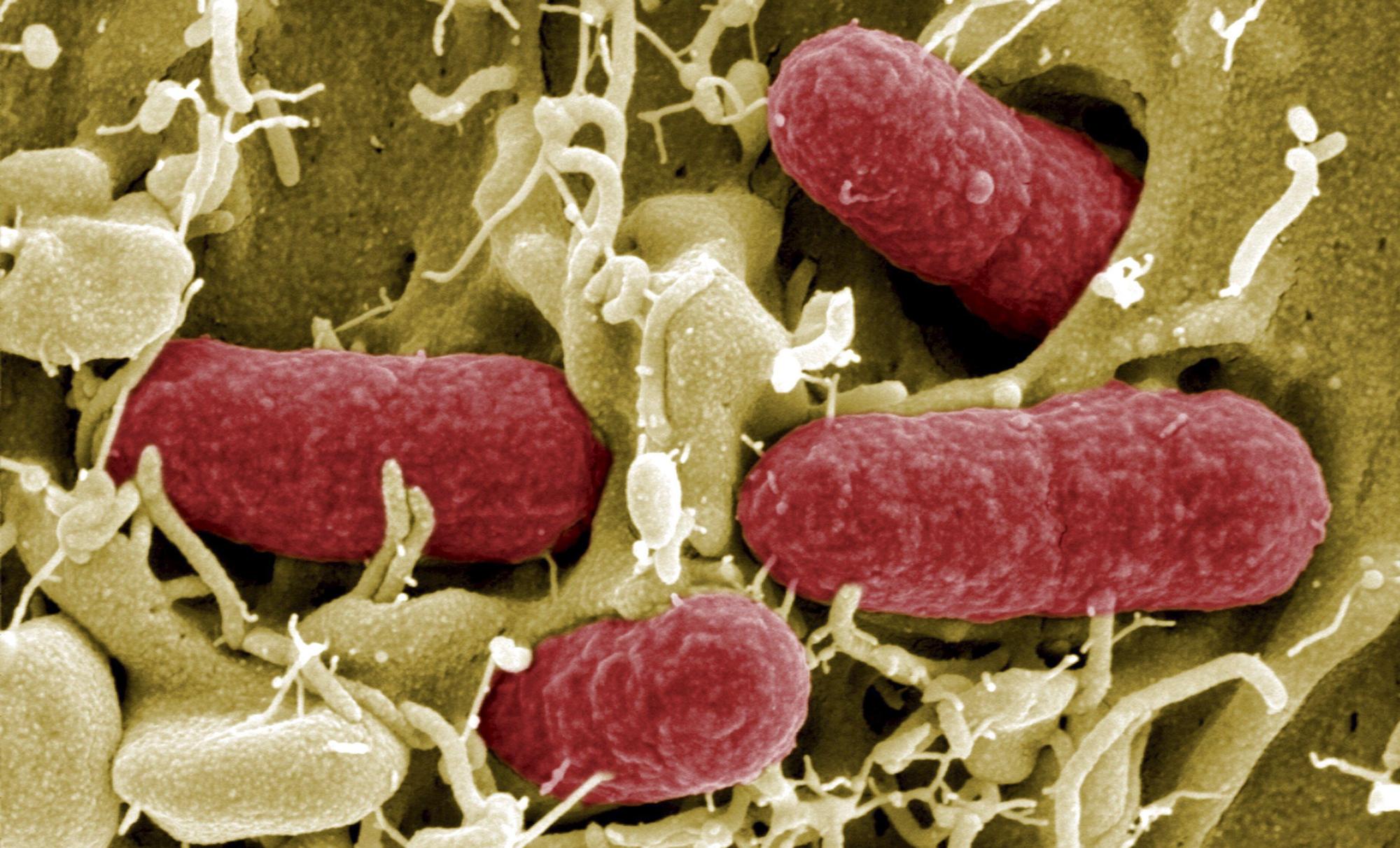 'Escherichia coli' bakterioaren anduia; antibiotikoekiko erresistentzia handia du. MANFRED ROHDE / EFE